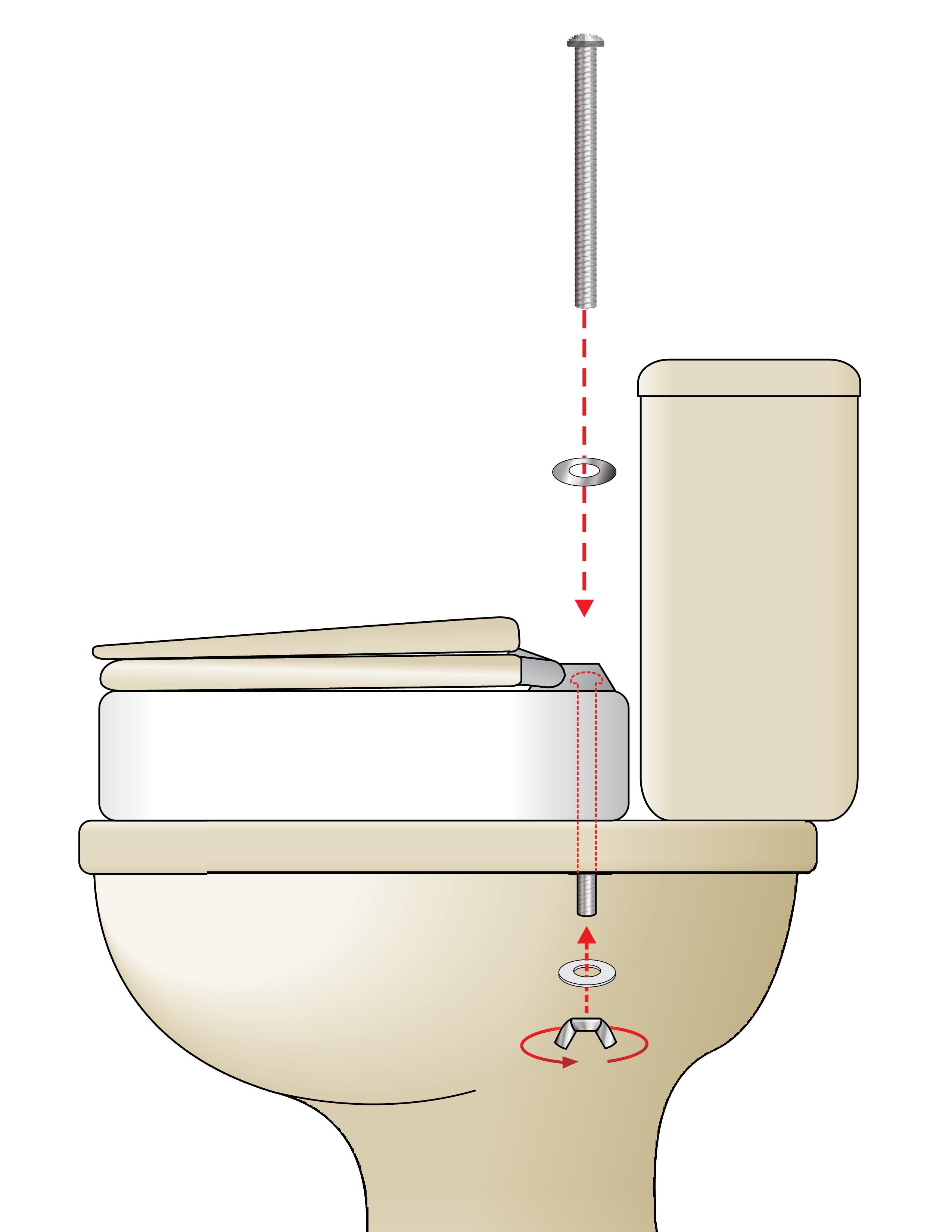 Toilet Riser & Toilet Bar Installation